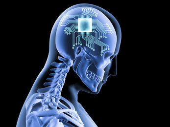 Bill Gates Invests in Synchron; Neuralink's Rival