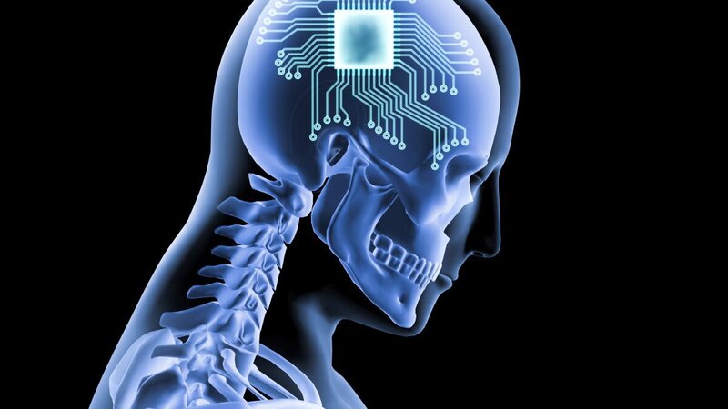 Neuralink Elon Musk: what is the Telepathy chip and what is it for